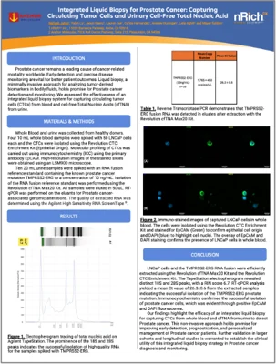 Integrated Liquid Biopsy for Prostate Cancer: Capturing Circulating Tumor Cells and Urinary Cell-Free Total Nucleic Acid resource thumbnail