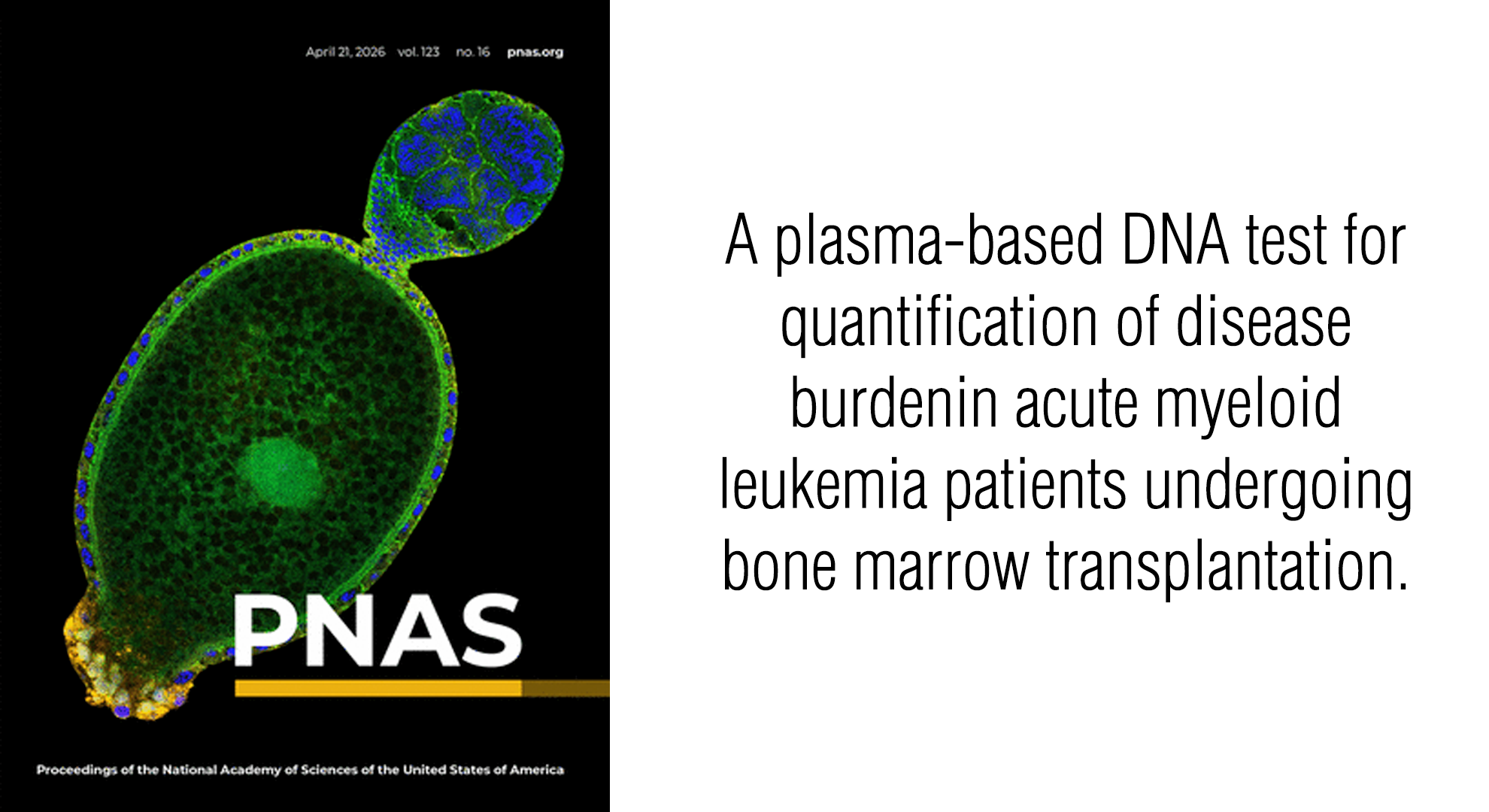 A plasma-based DNA test for quantification of disease burden in acute myeloid leukemia patients undergoing bone marrow transplantation. resource thumbnail